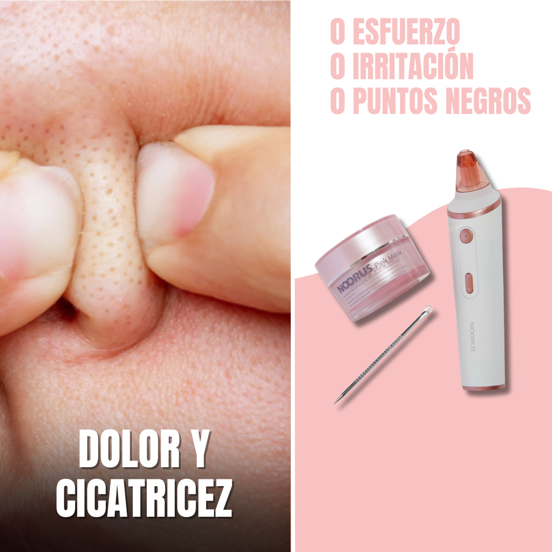 Extractor de puntos negros + Mascarilla + Espátula